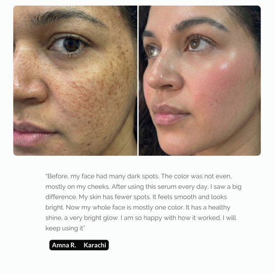 Glutathione Serum - Skin Brightening | 30ml