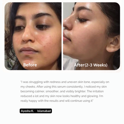 Glutathione Serum - Skin Brightening